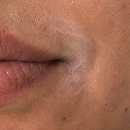 Skincare desaprovechado